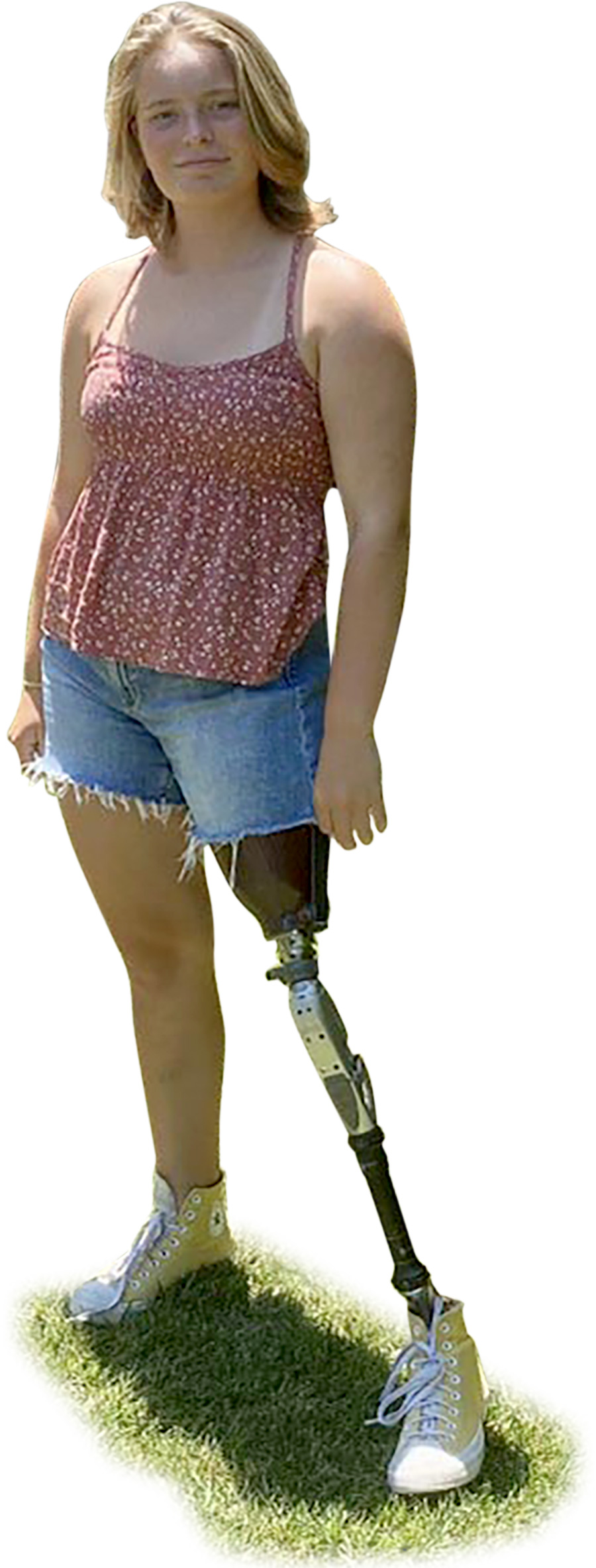 young girl with prosthetic leg