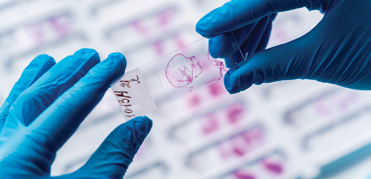 Tech holding a microscope sample slide